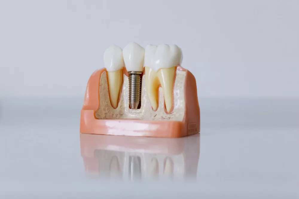 Unveiling Excellence: My Deep Dive into Parkview Dental and Implant Center